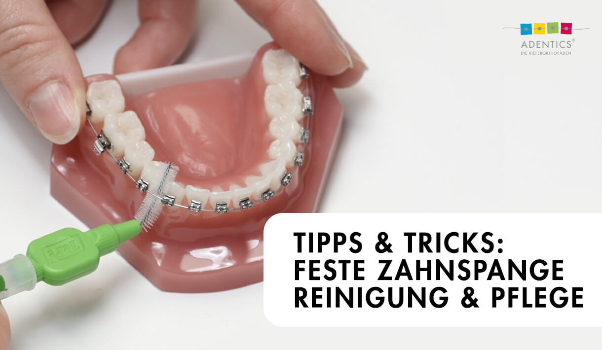 ADENTICS Video: Feste Zahnspange  – Tipps & Tricks zur Reinigung und Pflege