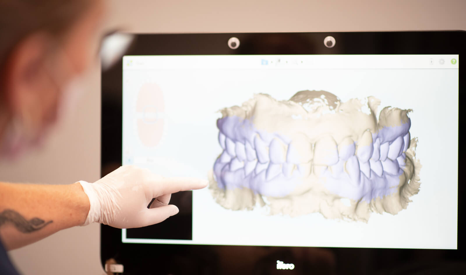 Digitale Kieferorthopädie - Gebiss Scan bei ADENTICS in Karow
