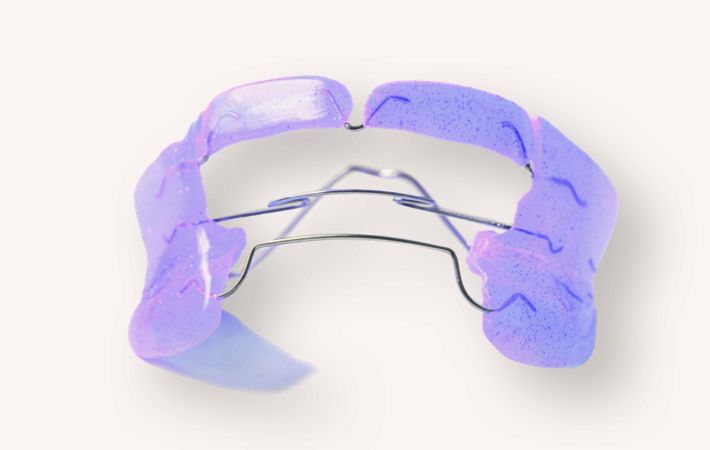  Haltespangen werden nach Abschluss einer aktiven kieferorthopädischen Behandlung eingesetzt und Sicherung der erreichten Zahn- und Kieferstellung.