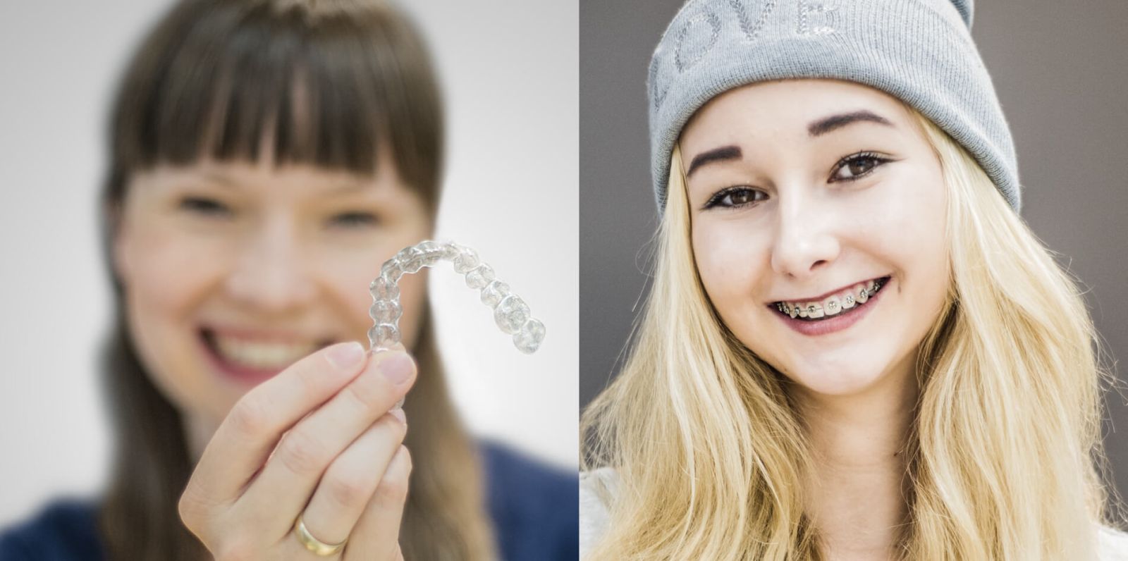 Aligner vs feste Zahnspange bei ADENTICS in Schulzendorf