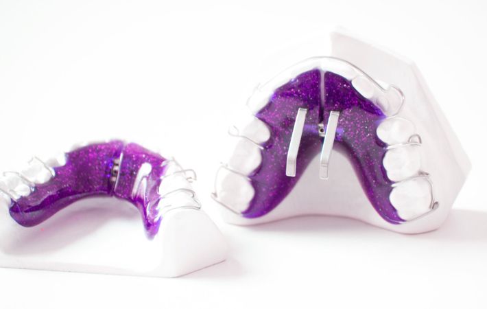 Doppelvorschub-Platte dient zur Wachstumssteuerung von Kieferanteilen und zur Regulierung der Zungen-, Kau- und Lippenfunktion.