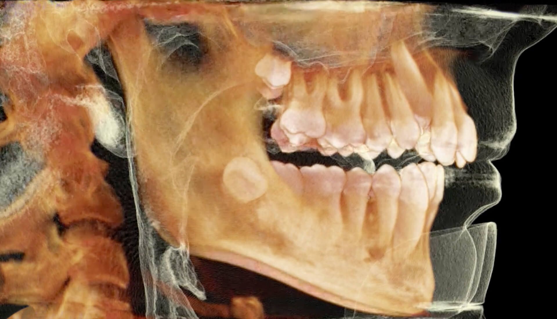 BE ADENTICS|  Hochmoderne 3D-Röntgen - Digitale Volumentomografie