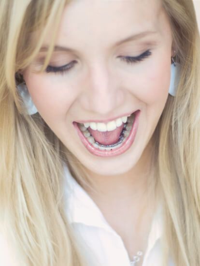 BEI ADENTICS | Suresamile Ligual - ist unsere aufwändigste Variante der kieferorthopädischen Behandlung  