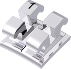 Metallbrackets  robuste und sehr wirtschaftliche Variante der festen Spange