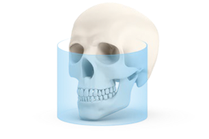 Digitale Volumentomografie| MODUS: Single-Scan TMJ Mode